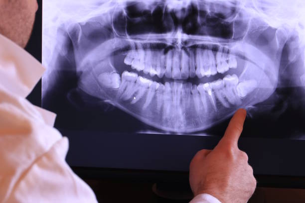 Best Emergency Denture Repair in Friend, NE