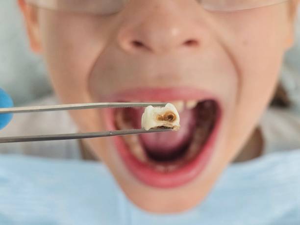 Best Cosmetic Emergency Dentistry in Friend, NE