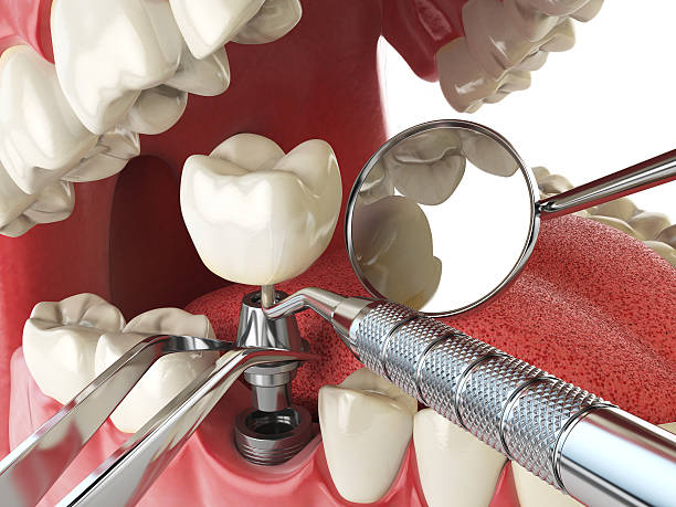 Best Emergency Treatment for Dental Infections or Abscesses in Friend, NE